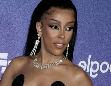 Doja Cat : ce détail (inattendu) de sa tenue aux Grammy Awards... qui vous a certainement échappé (et qui a fait le buzz) !