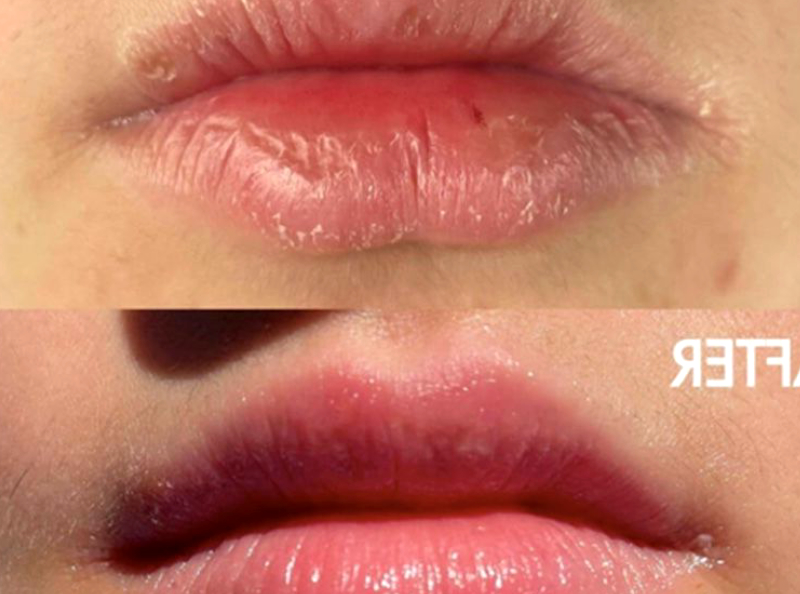 Lèvres gercées et sèches : Ce baume à lèvres emblématique (confirmé par Gigi Hadid) est vendu toutes les 60 secondes dans le monde.