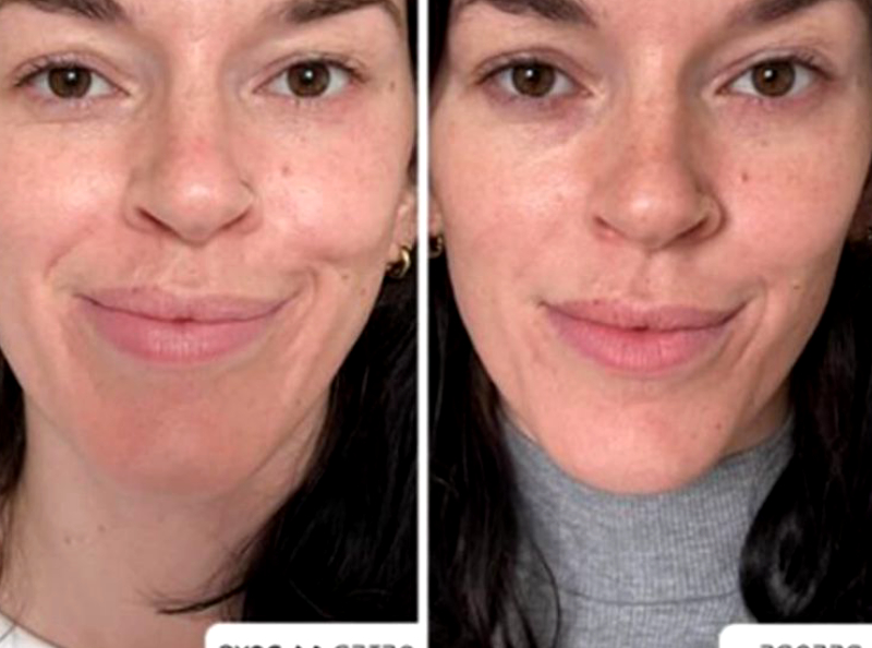 Teint terne : ce sérum à la vitamine C éclaircit et illumine le teint en seulement 14 jours