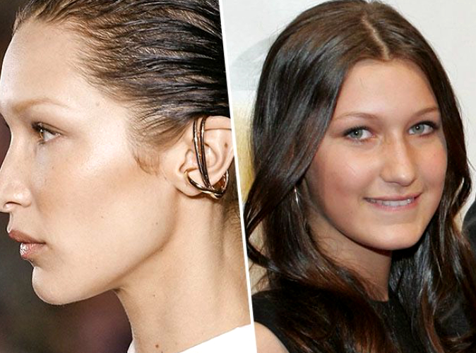 Bella Hadid avoue avoir eu recours à une rhinoplastie à seulement 14 ans et exprime ses regrets