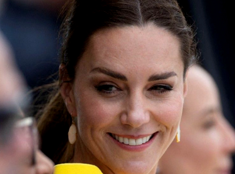 Kate Middleton rayonne en toutes circonstances : c'est LA tendance "Happy Face" de la médecine esthétique, lancée par la duchesse !