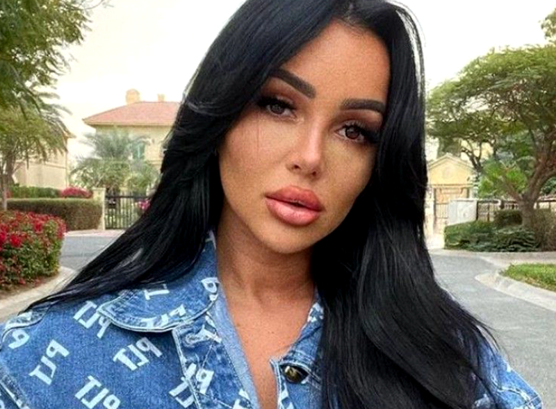 Fidji Ruiz défigurée : Mais qu'est-il arrivé au visage de la star de télé-réalité ?